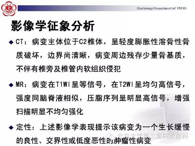 【病例】C2椎体血管瘤1例CT及MR影像表现