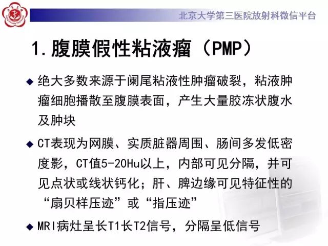 【病例】腹膜假性粘液瘤1例CT影像诊断