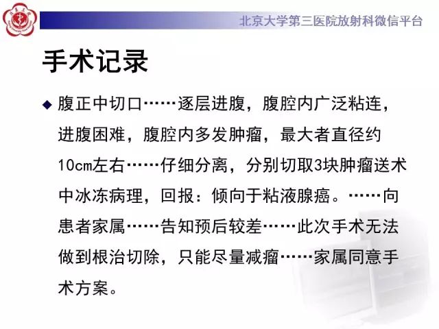 【病例】腹膜假性粘液瘤1例CT影像诊断