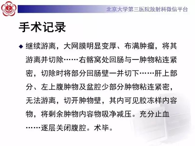 【病例】腹膜假性粘液瘤1例CT影像诊断