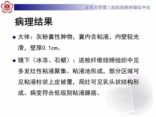 【病例】腹膜假性粘液瘤1例CT影像诊断