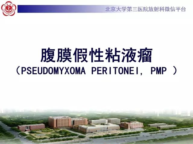 【病例】腹膜假性粘液瘤1例CT影像诊断
