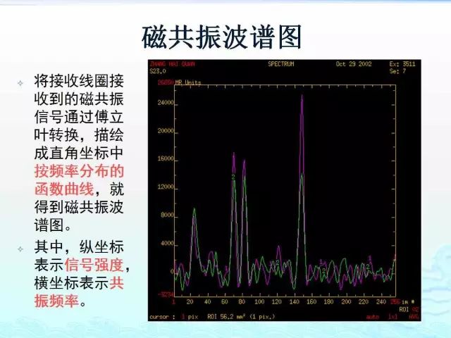 【PPT】MRS测定的代谢物及其临床含义