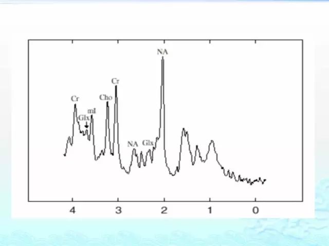 【PPT】MRS测定的代谢物及其临床含义