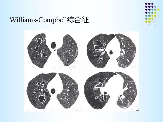 【PPT】肺多发囊状病变的CT诊断