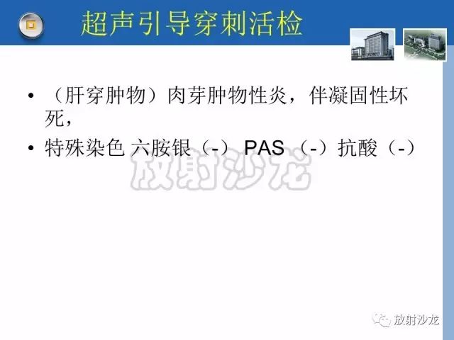 【病例】肝结核1例CT影像诊断