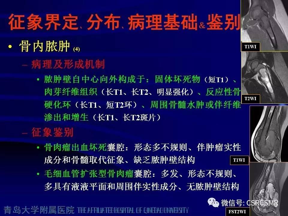【PPT】长骨骨髓炎与骨肉瘤—MR征象对比观察