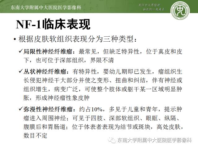 【病例】神经纤维瘤病1例MR
