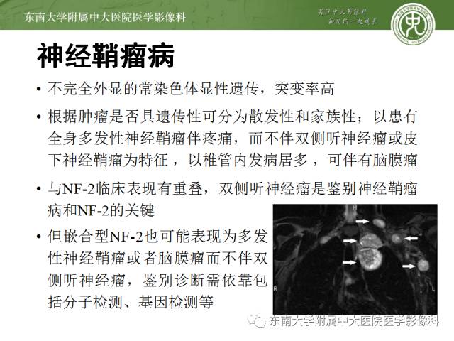 【病例】神经纤维瘤病1例MR
