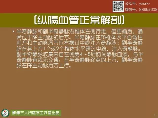 【PPT】纵隔内血管变异与CT诊断误区 【PPT】纵隔内血管变异与CT诊断误区
