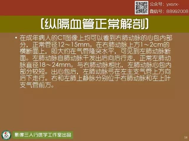 【PPT】纵隔内血管变异与CT诊断误区 【PPT】纵隔内血管变异与CT诊断误区