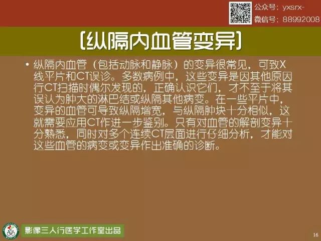 【PPT】纵隔内血管变异与CT诊断误区 【PPT】纵隔内血管变异与CT诊断误区