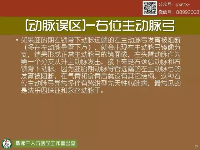 【PPT】纵隔内血管变异与CT诊断误区 【PPT】纵隔内血管变异与CT诊断误区