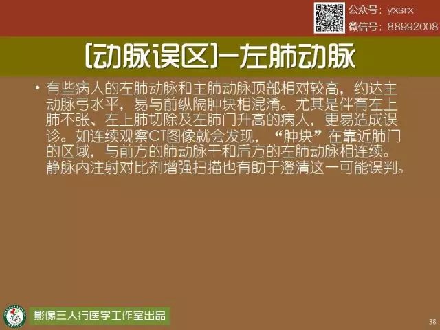 【PPT】纵隔内血管变异与CT诊断误区 【PPT】纵隔内血管变异与CT诊断误区