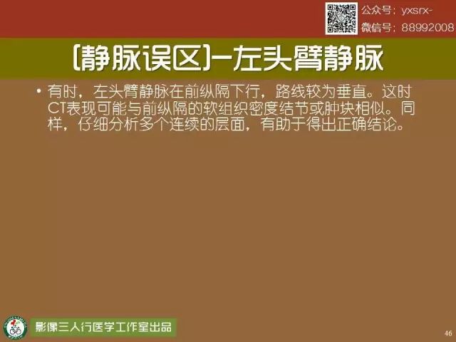 【PPT】纵隔内血管变异与CT诊断误区 【PPT】纵隔内血管变异与CT诊断误区