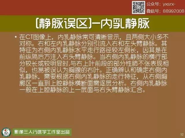 【PPT】纵隔内血管变异与CT诊断误区 【PPT】纵隔内血管变异与CT诊断误区