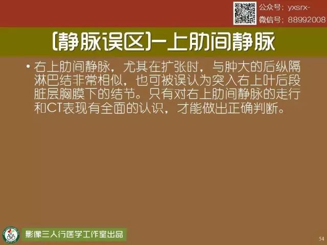 【PPT】纵隔内血管变异与CT诊断误区 【PPT】纵隔内血管变异与CT诊断误区