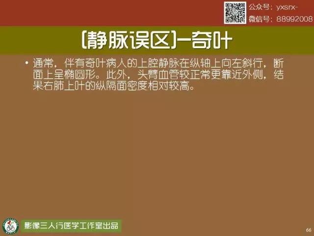 【PPT】纵隔内血管变异与CT诊断误区 【PPT】纵隔内血管变异与CT诊断误区