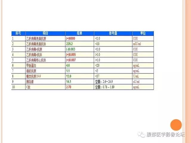 【病例】肝脏孤立性坏死结节SNN一例MR影像表现 【病例】肝脏孤立性坏死结节SNN一例MR影像表现
