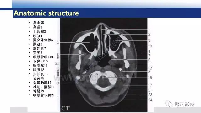 【PPT】鼻咽肿瘤性病变影像诊断