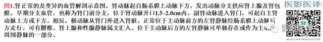 综述:肾血管病变的多模态影像学评估 综述:肾血管病变的多模态影像学评估