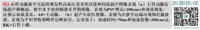 综述:肾血管病变的多模态影像学评估 综述:肾血管病变的多模态影像学评估