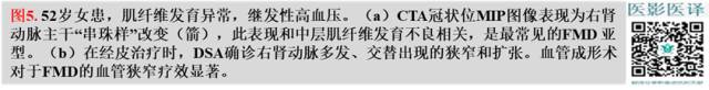 综述:肾血管病变的多模态影像学评估 综述:肾血管病变的多模态影像学评估