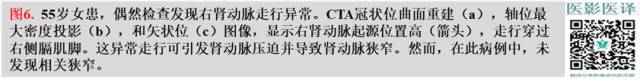 综述:肾血管病变的多模态影像学评估 综述:肾血管病变的多模态影像学评估