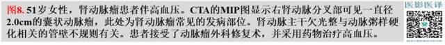综述:肾血管病变的多模态影像学评估 综述:肾血管病变的多模态影像学评估