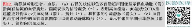 综述:肾血管病变的多模态影像学评估 综述:肾血管病变的多模态影像学评估