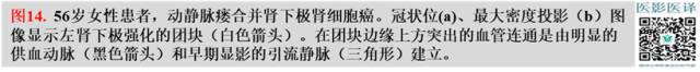 综述:肾血管病变的多模态影像学评估 综述:肾血管病变的多模态影像学评估
