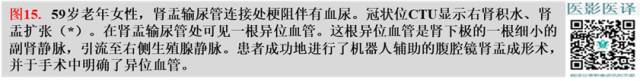 综述:肾血管病变的多模态影像学评估 综述:肾血管病变的多模态影像学评估