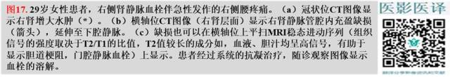 综述:肾血管病变的多模态影像学评估 综述:肾血管病变的多模态影像学评估