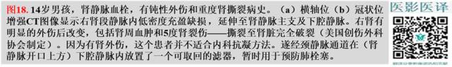 综述:肾血管病变的多模态影像学评估 综述:肾血管病变的多模态影像学评估