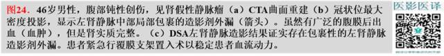 综述:肾血管病变的多模态影像学评估 综述:肾血管病变的多模态影像学评估