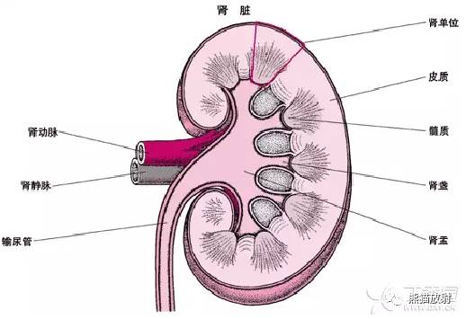 【双语病例】髓质海绵肾1例X线及CT鉴别诊断 【双语病例】髓质海绵肾1例X线及CT鉴别诊断