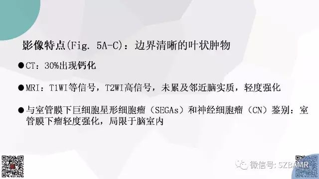 【PPT】脑室内肿瘤的影像诊断