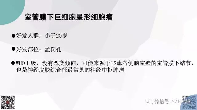 【PPT】脑室内肿瘤的影像诊断