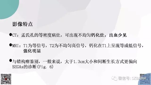 【PPT】脑室内肿瘤的影像诊断