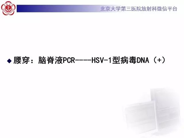 【病例】单纯疱疹病毒性脑炎1例CT及MR