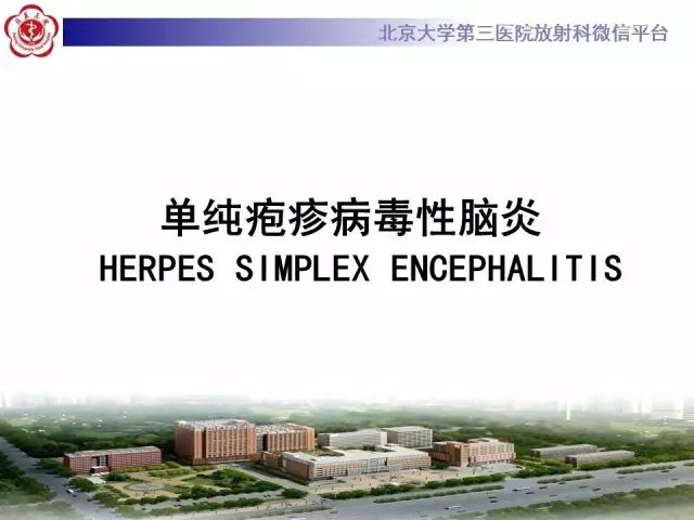 【病例】单纯疱疹病毒性脑炎1例CT及MR