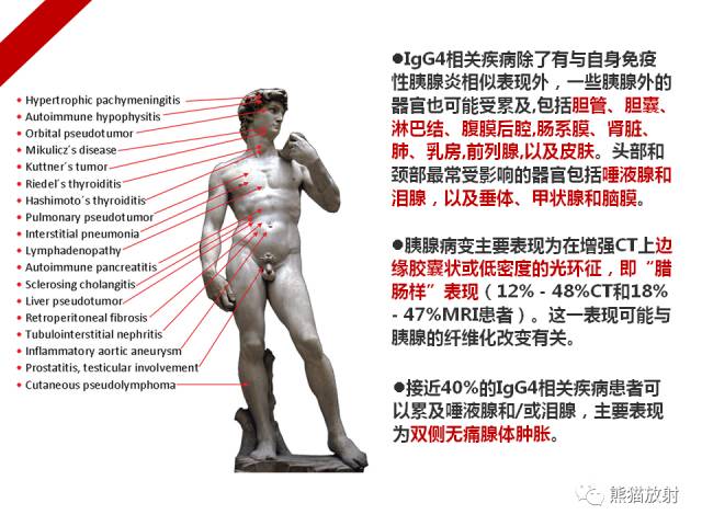 【病例】IgG4​相关性疾病1例PET/CT影像表现