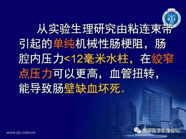 【PPT】急性绞窄性肠梗阻CT诊断