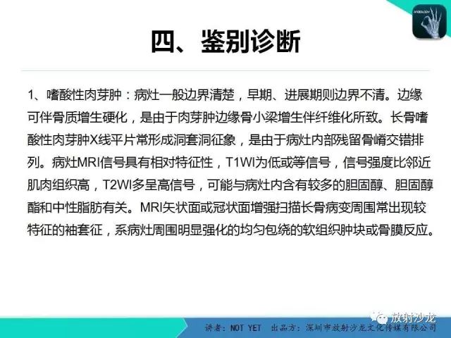 【病例】低毒性骨髓炎1例X线MR影像表现