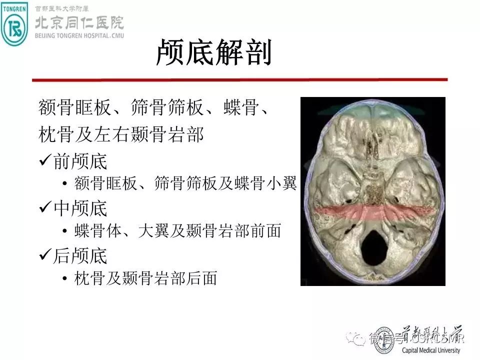 【PPT】颅底骨源性肿瘤影像学分析思路