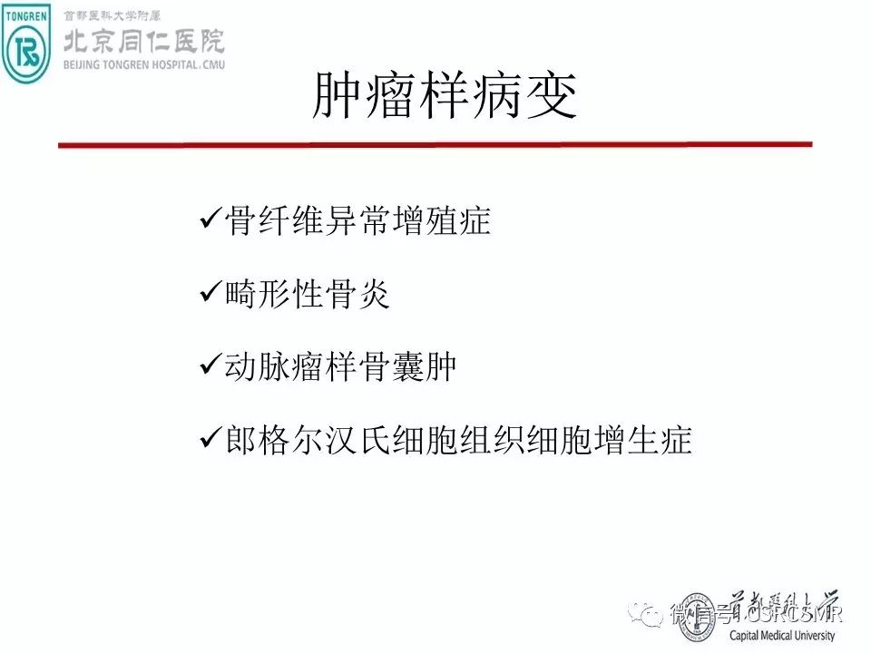 【PPT】颅底骨源性肿瘤影像学分析思路