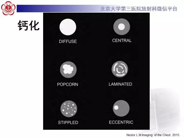 【PPT】(肺)结节(影像诊断)