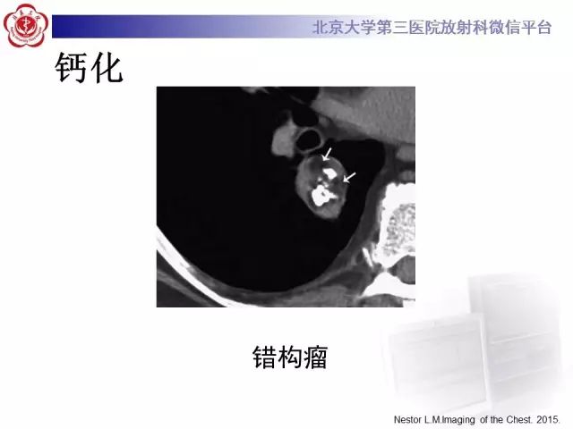 【PPT】(肺)结节(影像诊断)