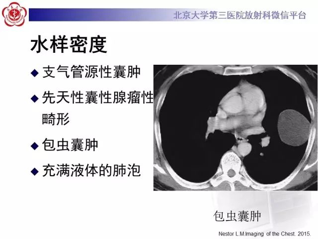 【PPT】(肺)结节(影像诊断)