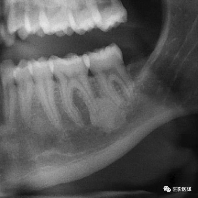颌骨良恶性肿瘤及肿瘤样变影像学诊断路径